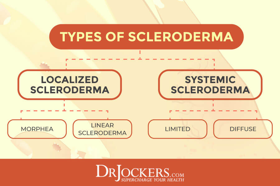 Scleroderma, Scleroderma: Causes, Symptoms, and Natural Support Strategies