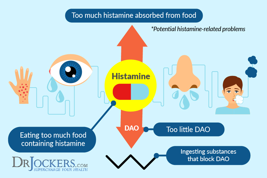 Histamine Intolerance, Are You Suffering From Histamine Intolerance?